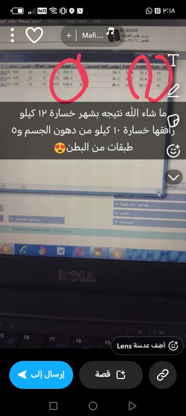 نتيجة خسارة وزن ودهون في عيادة سحر