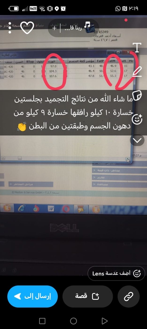 نتيجة موثقة لخسارة الوزن والدهون